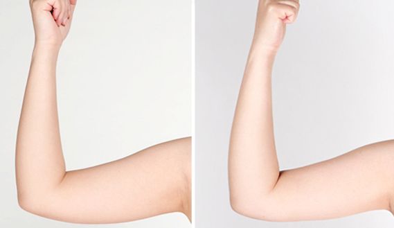 貴陽(yáng)有哪些專(zhuān)業(yè)治療痘印痘坑的醫(yī)院值得推薦？