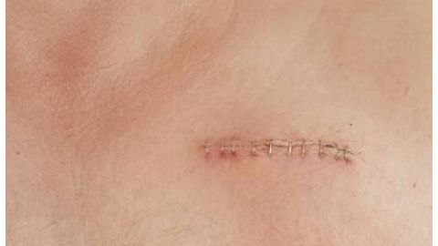 江蘇省中醫(yī)院整形科是否有專業(yè)資質(zhì)？醫(yī)生擅長(zhǎng)哪些項(xiàng)目？簡(jiǎn)介了解一下！