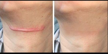 南京取出奧美定哪家好？南京市區(qū)有哪些口碑較好的奧美取出門店？