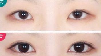 西安治療瘢痕哪家醫(yī)院好評(píng)不斷！