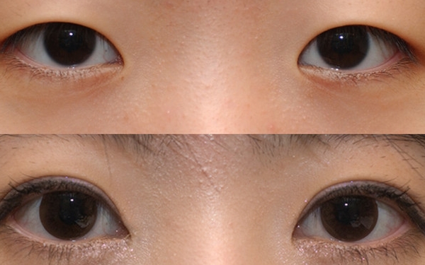 昆明韓辰陳寧醫(yī)生實力解析，技術評估及特色服務一覽!