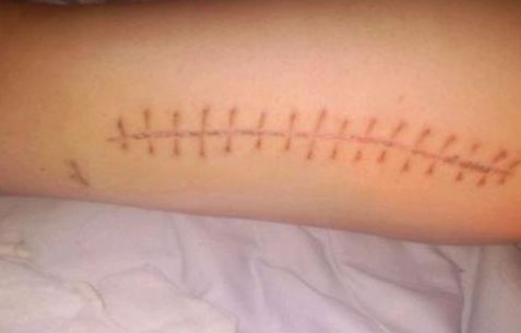 常熟哪家看痘痘醫(yī)院好？專家推薦常熟治療痘痘靠譜的醫(yī)院有哪些？