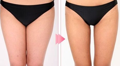 廊坊去斑的醫(yī)院哪家好？推薦您去哪家專業(yè)的醫(yī)院進(jìn)行去斑治療