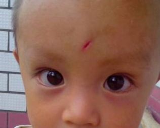 青島童顏線雕提升哪家好？選擇最佳青島童顏線雕醫(yī)院的3個關鍵因素