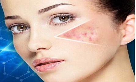 南京哪家醫(yī)院做埋線雙眼皮效果好？