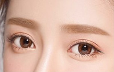 2023汕頭皮膚磨削治太田痣排名前幾的醫(yī)生(黎國權(quán)、蘇國藝、梁威杰網(wǎng)友認可度高)