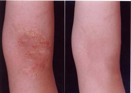 2023沈陽(yáng)面下2/3除皺口碑排行前10專(zhuān)家(莊綏、張晨、連園園看到就是賺到)