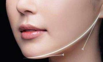 2023西安膠原蛋白祛妊娠紋醫(yī)生前十排名榜(寇晨程、欒琪、羅盛康高人氣票選出圈)