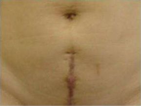 天津祛痘醫(yī)院哪家效果好？為您推薦天津?qū)I(yè)祛痘醫(yī)院排行榜