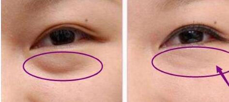 東莞豐胸醫(yī)生名單推薦！權(quán)威醫(yī)師梁如光、鄭志敏等值得信賴