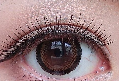 2023武漢鐳射激光祛抬頭紋口碑好的專家(余衛(wèi)平、馬志丹、曾祥蘭口碑實力印證，值得一覽)