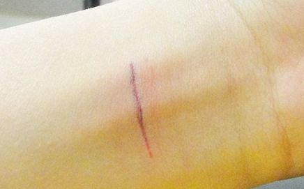 上海哪家隆鼻醫(yī)院好且正規(guī)？優(yōu)質(zhì)咨詢幫助你挑選合適的醫(yī)院