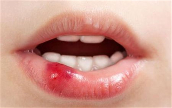 2023貴州祛頸紋嗨體權(quán)威醫(yī)生排名榜前十(魏在榮、張凱、張連洪這份專家名單推薦給你)