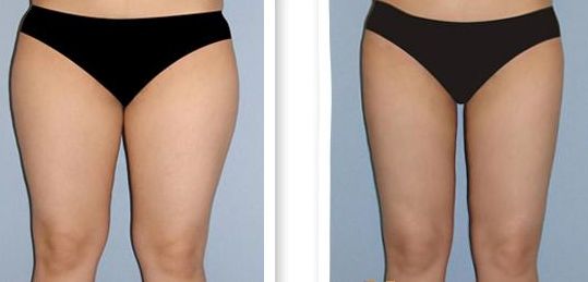 泉州醫(yī)院哪家做手術(shù)好？選泉州醫(yī)院手術(shù)排名榜單