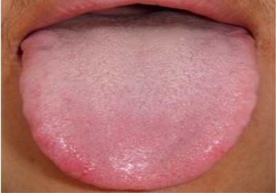 2023淮安鼻子綜合整形權(quán)威專家評價前10位(趙步祥、房進、熊猛老用戶強力安利)