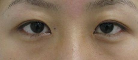 南寧哪家美容整形醫(yī)院口碑好又實惠？