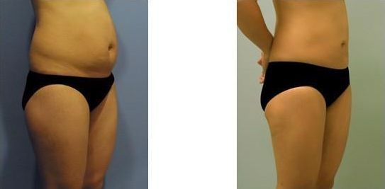 濟南哪家醫(yī)院做雙眼皮效果好？