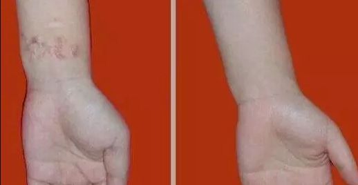 杭州哪家醫(yī)院看喉嚨好？排名最好的專業(yè)醫(yī)院推薦