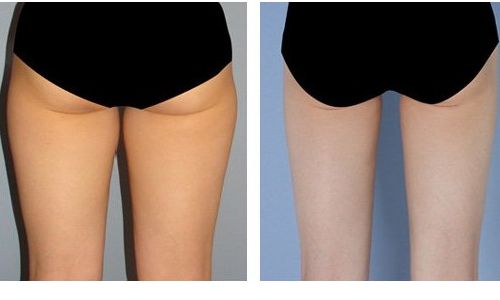 重慶康美整形美容醫(yī)院門診有用戶好評嗎？醫(yī)生資料和價格表全面解讀