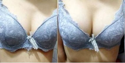 上饒雙眼皮手術(shù)哪家醫(yī)院好？專業(yè)排名推薦！