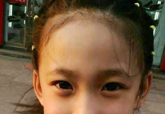 蘇州激光祛疤哪家醫(yī)院好？選擇激光祛疤專家，恢復(fù)美肌無(wú)憂！