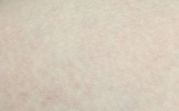 大連哪位醫(yī)生在顴骨整形方面?zhèn)涫懿毮?？關(guān)注的5位專家包括關(guān)世超、張東、蔡軍。