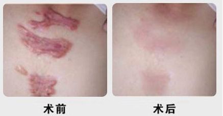 昆明有沒有哪家專業(yè)祛痘醫(yī)院值得推薦？