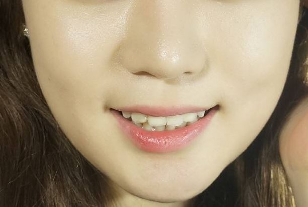 廣州集美醫(yī)療美容怎么樣？廣州集美醫(yī)療美容簡(jiǎn)介|醫(yī)生團(tuán)隊(duì)|口碑評(píng)價(jià)！