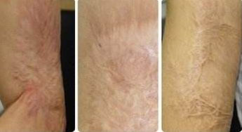 【2023廈門】專業(yè)廈門埋線減肥醫(yī)院哪家口碑好？