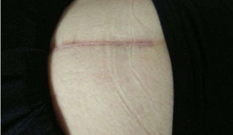 杭州市哪家醫(yī)院的玻尿酸注射技術(shù)更好？附醫(yī)生資料及整形科點(diǎn)評