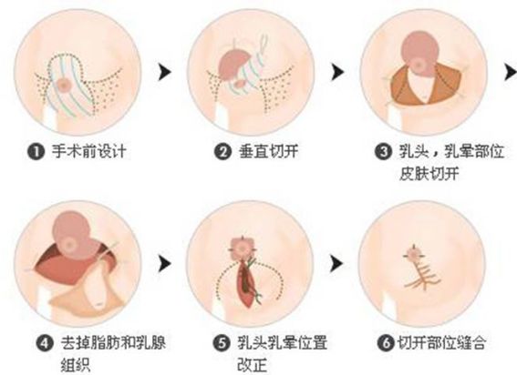 保定的整形醫(yī)院哪家好？全面解析保定整形醫(yī)院排名、口碑、專業(yè)團隊等