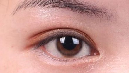 蘇州雙眼皮修復(fù)醫(yī)院排名及口碑，哪家醫(yī)院修復(fù)效果最好？