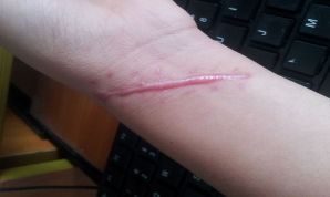 上海鼻子整形哪家醫(yī)生好？整形手術(shù)中哪位醫(yī)生在上海受歡迎？