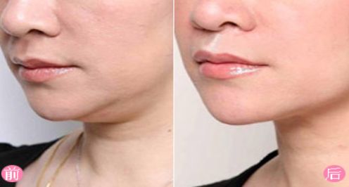 上海去除胎記醫(yī)院排名及口碑評(píng)測(cè)，哪家醫(yī)院最受用戶好評(píng)？