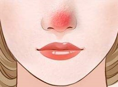 廣州最新開設(shè)的軍事美容整形醫(yī)院，王世虎是權(quán)威整形專家，手術(shù)價便宜