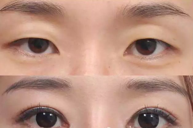 2023常德光纖溶脂減手臂在榜名單top10強專家(陳貴南、梁亮、李元全熱門口碑專家集中匯總！)