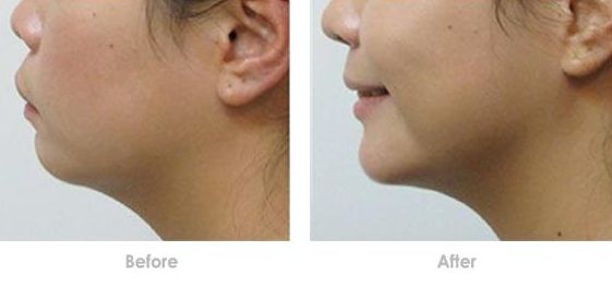 成都哪家醫(yī)美醫(yī)院做皮秒好？了解成都皮秒治療哪家醫(yī)院口碑好