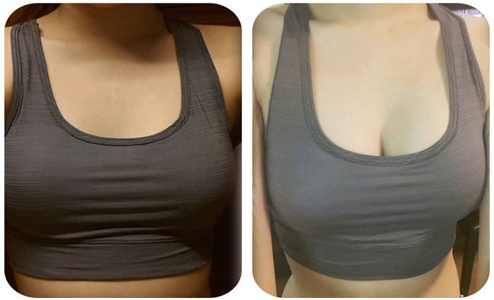 2023周口上眼瞼玻尿酸填充大型醫(yī)生口碑排名(宋明義、湯芳芳、趙北永公立私立都有)