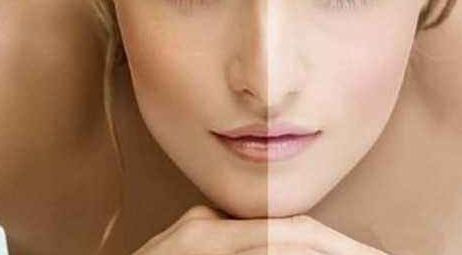 昆明整形哪家好卓星贊揚？解讀昆明整形行業(yè)卓星贊揚