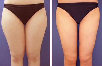 廣州看痘印哪家醫(yī)院好？細數(shù)廣州治療痘印最佳醫(yī)院！