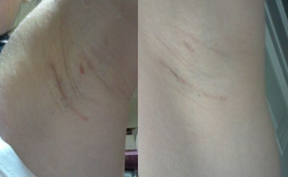 恩施地區(qū)有哪些信譽好的美容整形醫(yī)院？