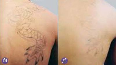 無錫哪家醫(yī)院眼科專業(yè)好？