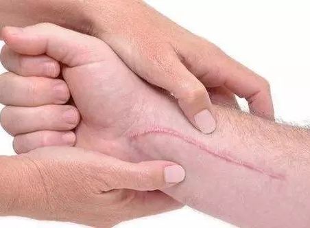 昆明雙眼皮修復，哪家醫(yī)院專業(yè)且可靠？