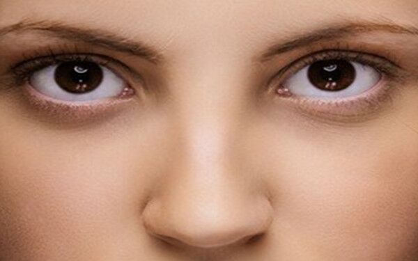 李運(yùn)峰醫(yī)生下頜角手術(shù)的效果如何？丨下頜角案例：“瓜子臉”與“蛇精臉”形態(tài)有何不同