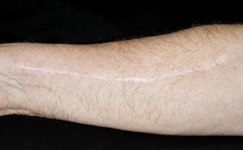 2023青島眼周紋手術去除醫(yī)生前十位強榜(蔡霞、吳延芳、劉肅資質權威)