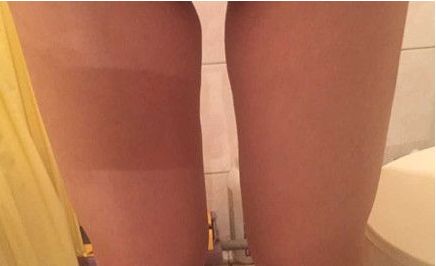 山東哪家醫(yī)院治療疤痕好？挑選最適合您的醫(yī)療機(jī)構(gòu)！