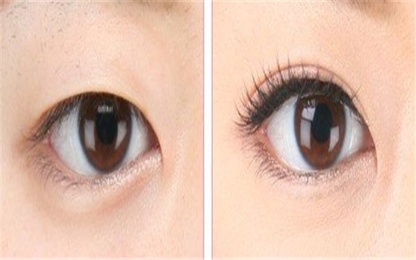 中國哪家醫(yī)院皮膚修復(fù)好？專家告訴你最靠譜的皮膚修復(fù)醫(yī)院有哪些