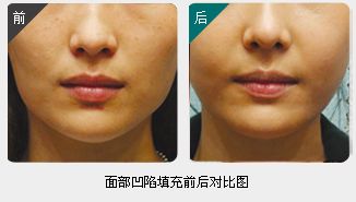 錦州整形美容醫(yī)院哪家靠譜？醫(yī)療技術(shù)如何？