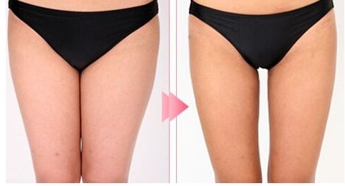 昆明哪家醫(yī)院做拉皮手術(shù)好？體驗(yàn)分享+專家推薦，盡在本文！