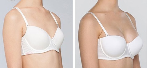 2023貴陽肉毒素去皺紋專家強(qiáng)榜前十(童大潮、申槿緹、周澤興備受歡迎~)